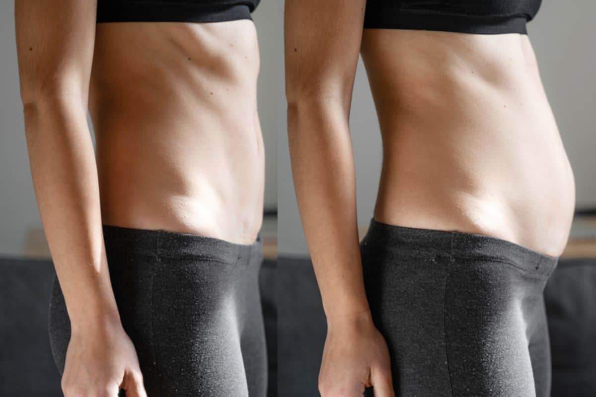 How long does diastasis recti take to improve Hamilton?