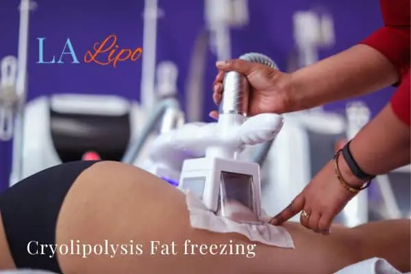 women getting fat freezing Hamilton