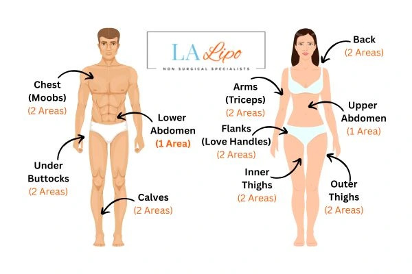 LA LIPO Cryolipolysis Areas Hamilton