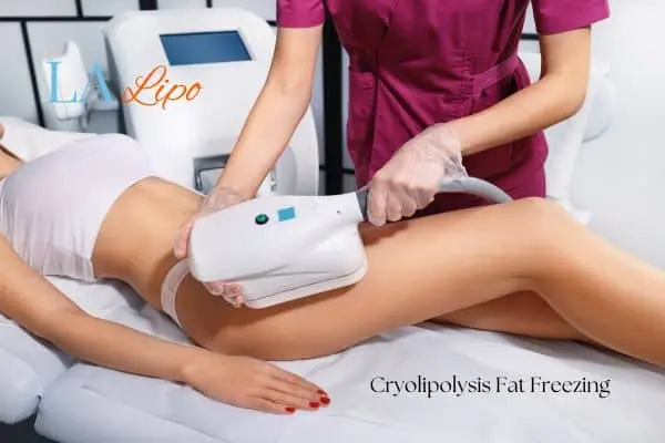 Woman receiving coolsculpting Hamilton treatment on her thighs