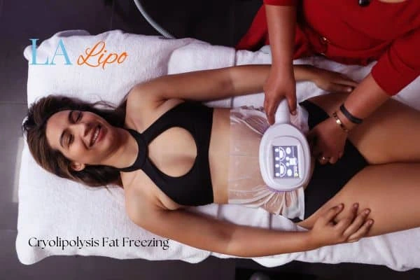 woman getting cryolipolysis Hamilton