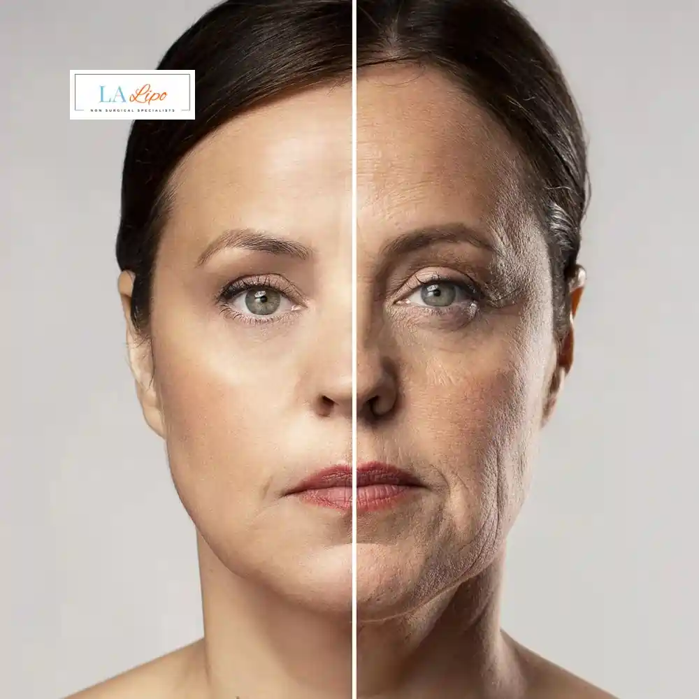 How Can You Tell If Non-Surgical Skin Tightening Is Right for You Hamilton?