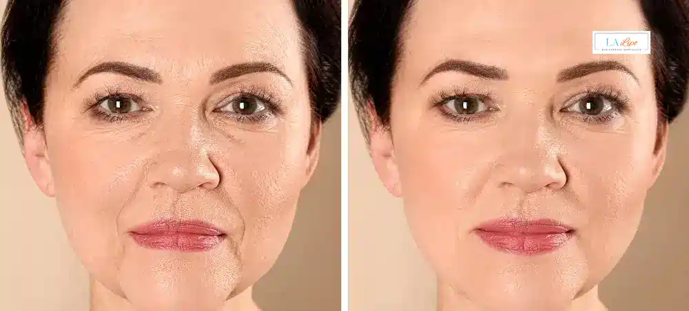 How Long Does It Take to See Results and How Long Do They Last Hamilton?